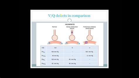 v/q ratio mismatch|what causes v q mismatch.